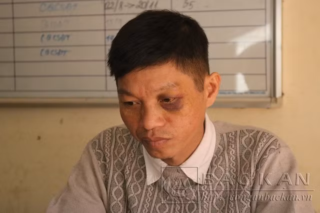 Đối tượng Nông Văn Mạng tại cơ quan công an (Ảnh: Công an Bắc Kạn).