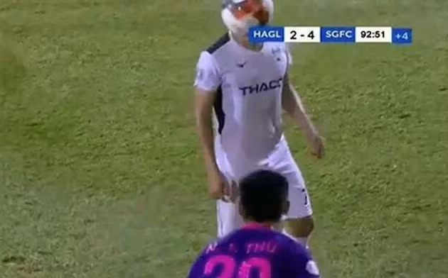  Thanh Thụ ném bóng thẳng vào mặt của Hồng Duy. 