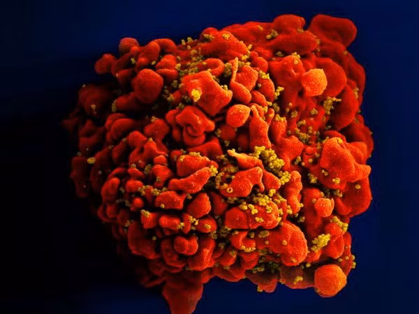 Virus HIV. (Nguồn: independent.co.uk)