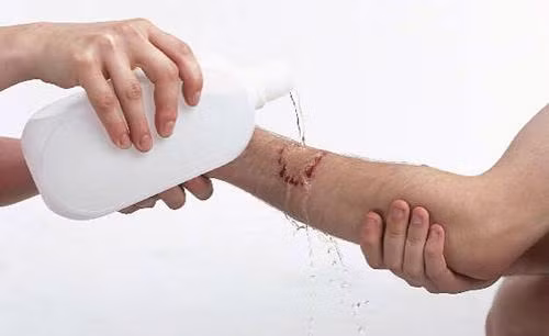 Khi bị chó, mèo cắn cần kiểm tra vết thương để xác định mức độ nặng nhẹ và tìm hướng xử trí