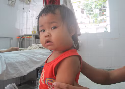 Mùa lạnh là thời điểm trẻ em dễ mắc bệnh quai bị. 