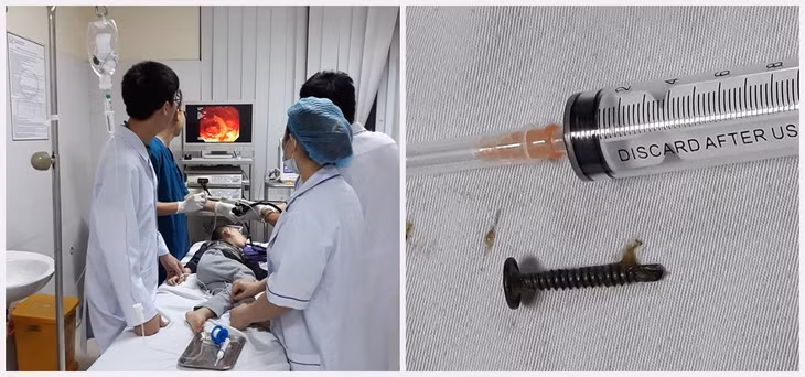Bác sĩ nội soi lấy dị vật thành công cho bệnh nhi