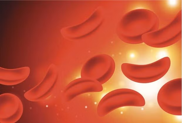 (Nguồn: Medical News Today)
