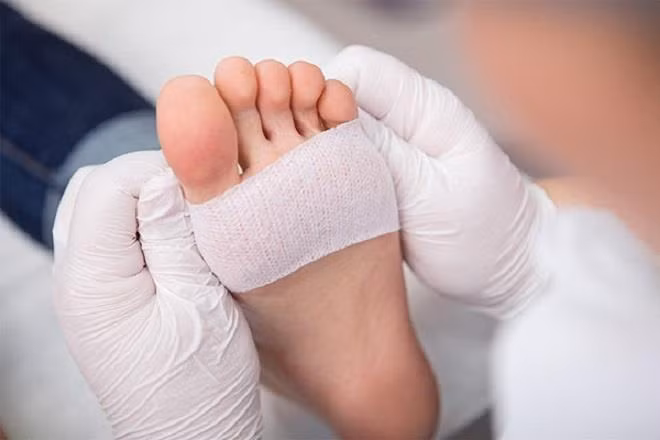 Vết thương khó lành là dấu hiệu tiêu biểu của bệnh tiểu đường. (Ảnh minh họa: Wetreatfeet)