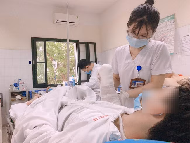 Các bác sĩ không thể cứu được bàn tay dập nát do pháo nổ của bệnh nhân, buộc phải cắt bỏ. (Ảnh: BV Việt Đức)