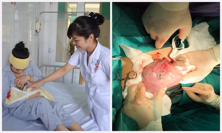 Hải Hà: Cứu sống hai mẹ con sản phụ bị rau bong non -