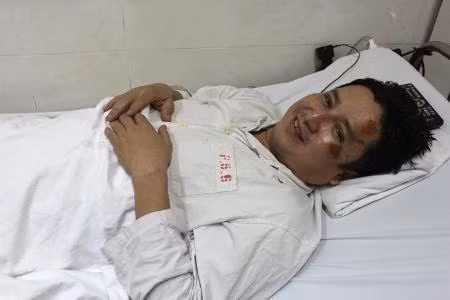 NSƯT Chí Trung bị tai nạn giao thông