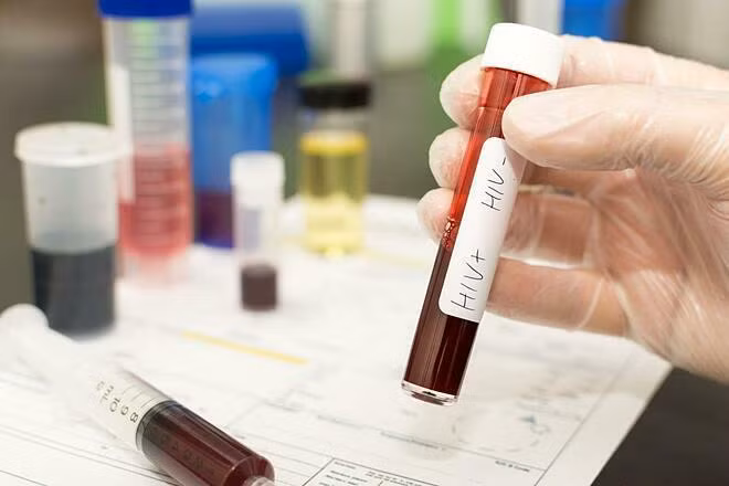 Các bệnh truyền nhiễm, trong đó có HIV được ước tính gây ra 4 triệu cái chết trong năm 2020. Ảnh: Medical News Today