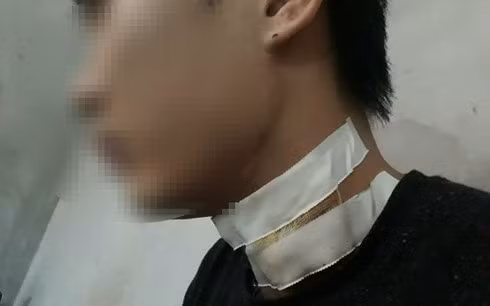 Anh T. bị ảnh hưởng đến sức khỏe sau sự việc.