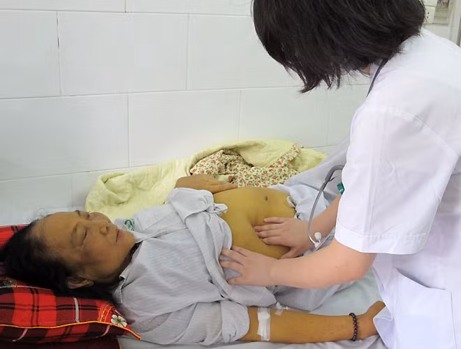 Bệnh nhân 61 tuổi đang điều trị tại khoa Truyền nhiễm, Bệnh viện Bạch Mai do biến chứng của nhiễm virus viêm gan B. Ảnh: N.P.