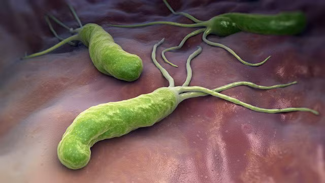H. pylori gây ra tình trạng khó tiêu, đầy bụng, viêm nhiễm... làm bệnh dạ dày nặng hơn và là tiền đề của ung thư dạ dày.