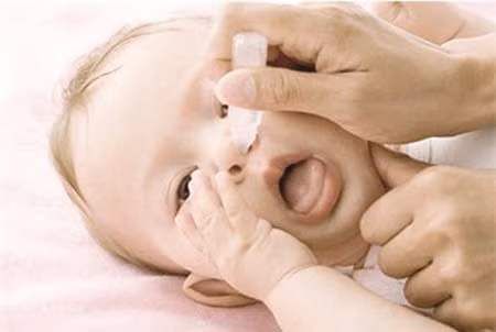 Trẻ có thể bị viêm mũi do lạm dụng thuốc nhỏ mũi.