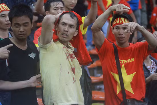 CĐV đổ máu trên sân Shah Alam. 