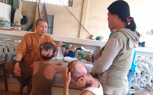 Các nhà hảo tâm thăm, tặng quà cho 2 em bị "bệnh lạ"