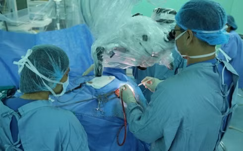 Ca phẫu thuật gắp sán nhái trong não bệnh nhân.