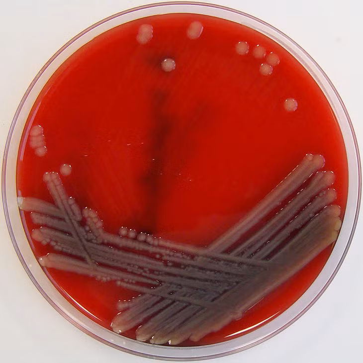 Loại vi khuẩn này có tên khoa học là Aeromonas Hydrophila (AH), dạng hình que, thường gặp ở vùng có khí hậu ấm, ở môi trường nước ngọt và nước lợ.