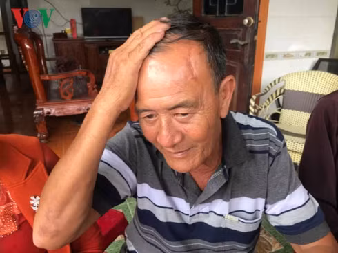 Vết thương trên đầu khiến ông Dương mất trí nhớ nhiều năm qua.