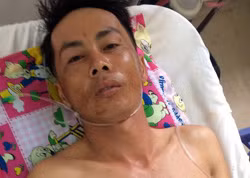 Nghi can Phan Văn Tâm tại bệnh viện. Ảnh: Hồng Tuyết.