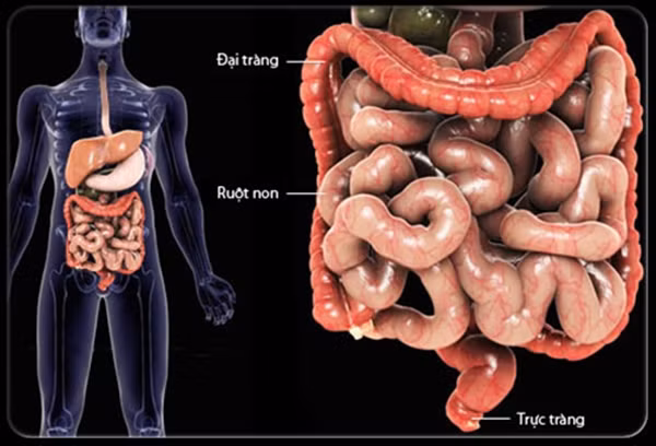  Giảm lượng cholesterol trong cơ thể sẽ giúp tránh được nhiều nguy cơ bệnh tật trong đó có ung thư đường ruột. (Ảnh minh họa)