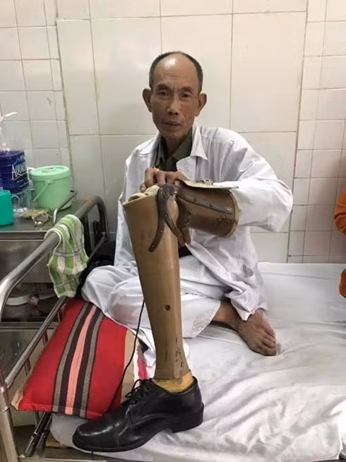 Chỉ vì va quệt giao thông, thương binh Hoàng Tiến Vin (62 tuổi ở Chương Mỹ) bị quây đánh hội đồng.