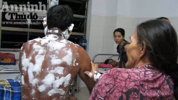 Ông Đồng đang điều trị tại bệnh viện đa khoa Phú Yên