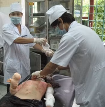 Cháu Bích đang được cấp cứu tại BV.