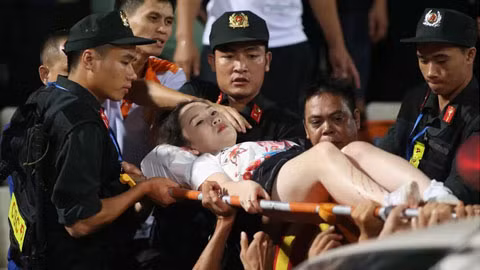 CĐV nữ bỏng nặng, đi cấp cứu vì bị tấn công bằng pháo sáng.