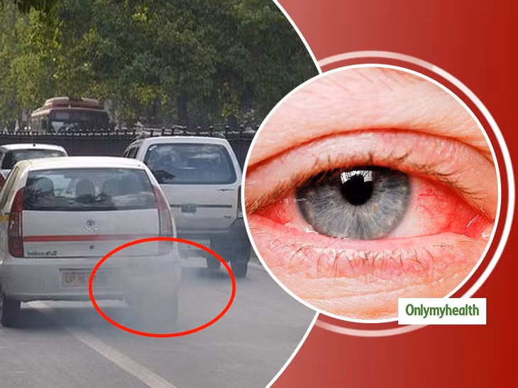 Tiếp xúc với khói xe trong thời gian dài làm tăng nguy cơ thoái hóa điểm vàng.