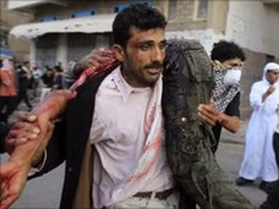Số người chết do lực lượng an ninh Yemen đàn áp ngày càng tăng. Ảnh: Reuters.
