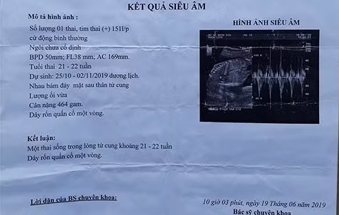 Kết quả siêu âm thai của bé N.T.L.