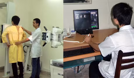 Máy X-quang kỹ thuật số thế hệ mới, do Vinacomin tặng Bệnh viện Việt Nam-Thụy Điển Uông Bí. 