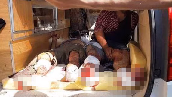 Người dân Syria bị thương do các cuộc bắn pháo của quân đội Thổ Nhĩ Kỳ ngày 18/10. (Ảnh: SANA).