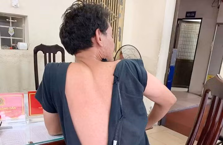  Nạn nhân Lê Sinh Tuấn bị đánh thương tích, rách quần áo.