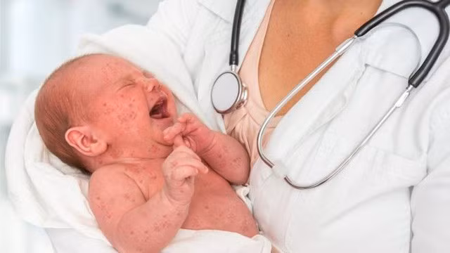 Đức phạt 2.500 euro nếu cha mẹ không tiêm phòng sởi cho con. Ảnh minh họa: Getty