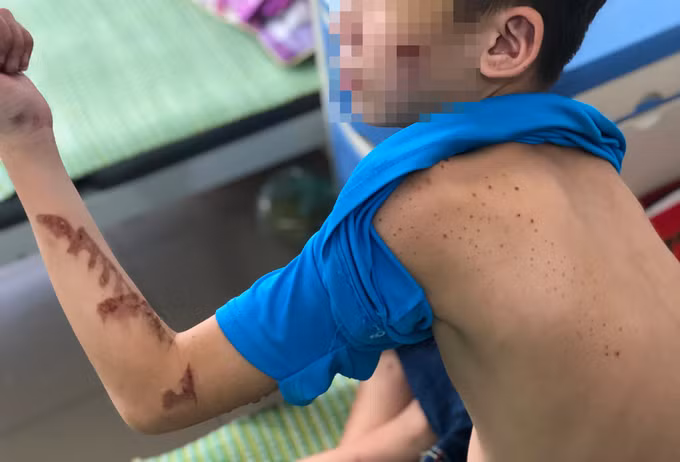 Duy tại bệnh viện trong sáng 23/11. Ảnh: Phạm Dự.