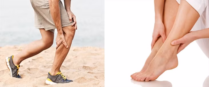 Mất nước và mất cân bằng điện giải là một trong những nguyên nhân gây hiện tượng chuột rút. Đồ họa: Kim Nhung