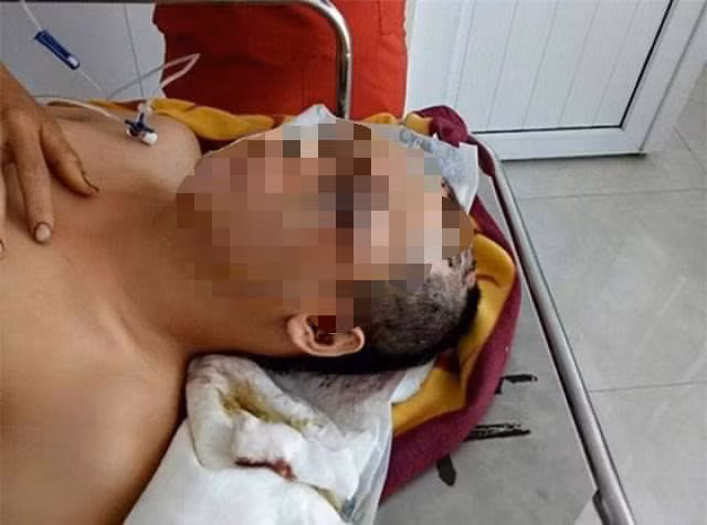 Sau nhiều ngày điều trị tại bệnh viện, anh Vũ thiệt mạng do vết thương quá nặng.