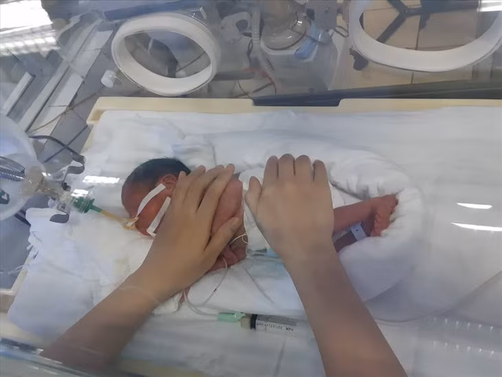Bé Bình An được chăm sóc đặc biệt tại Trung tâm chăm sóc và điều trị sơ sinh- BV Phụ sản TƯ. Ảnh: Thùy Linh
