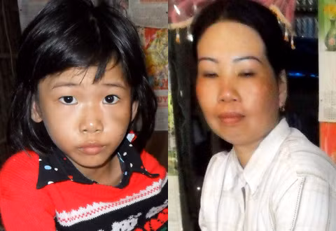 Người mẹ giải thích giận quá lỡ đánh gãy tay con gái. Ảnh: T.P.