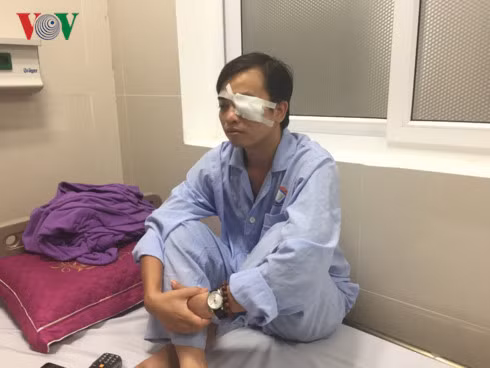 Bác sĩ Sơn với thương tích ở mắt đang điều trị tại bệnh viện.