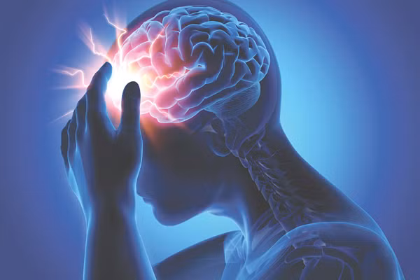 Đột quỵ không chừa bất kỳ ai