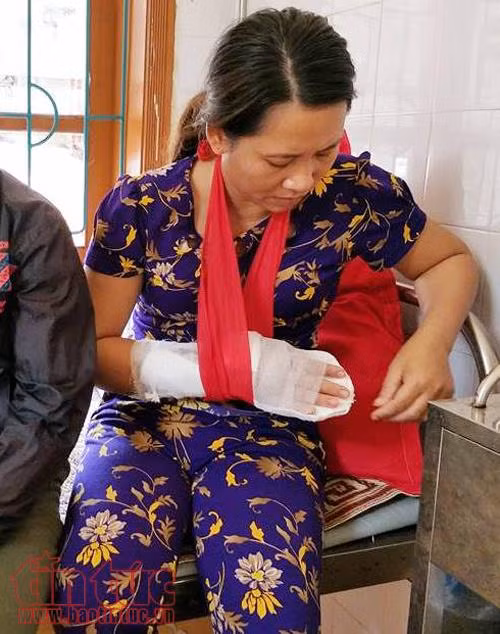 Chị Hải bị chém trọng thương đang được điều trị tại Bệnh viện Đa khoa huyện.