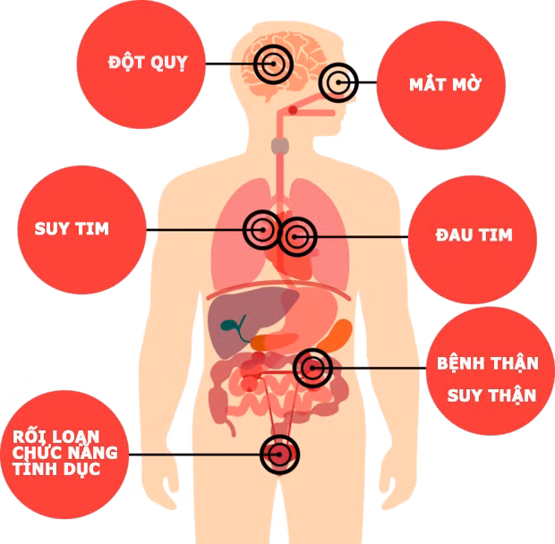 Các biến chứng của bệnh tăng huyết áp.