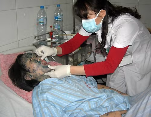 Phòng bệnh thủy đậu, cha mẹ nên đưa con đi tiêm văcxin. 