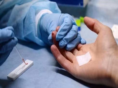  Bệnh viện Bệnh Nhiệt đới TP.HCM cho biết đã tiếp nhận 10 người dân đến tư vấn, điều trị dự phòng phơi nhiễm HIV do bị một người đàn ông lạ mặt dùng vật sắc nhọn gây thương tích ở tay, lưng (Ảnh minh họa)