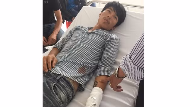Đối tượng Tiến đang được điều trị tại Bệnh viện Đa khoa huyện Đác Min, tỉnh Đác Nông.