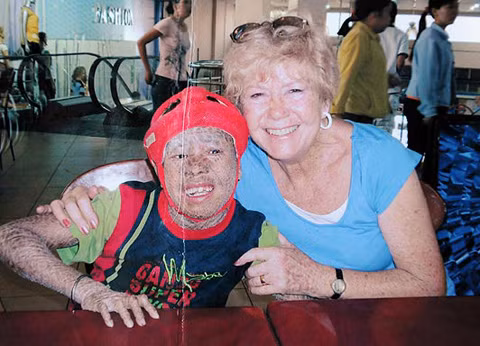 Bà Brenda Smith chụp ảnh cùng cậu bé "người cá" Minh Anh trong một lần đến thăm Việt Nam. Ảnh: Bacroft Media