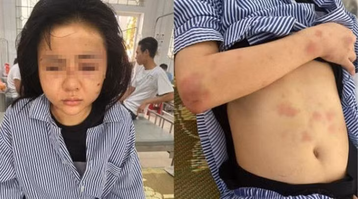 Hình ảnh những vết thương của nạn nhân khi nhập viện.