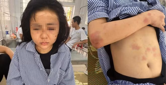 Hình ảnh nữ nạn nhân L khi nhập viện.