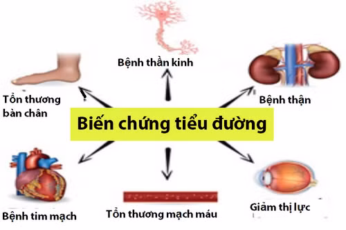 Cảnh giác biến chứng xương khớp ở bệnh nhân đái tháo đường.